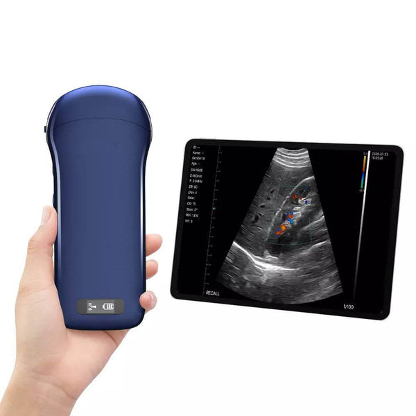 3-in-1 Wireless Ultrasound Scanner (CLP5) – Ultralife Medical Inc.