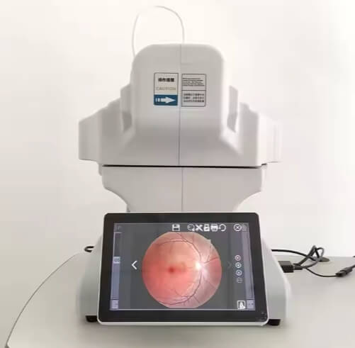 Ophthalmic Angiography Eye Non-Mydriatic Digital Fundus Camera