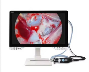 UHD Display Medical Endoscopy Camera System