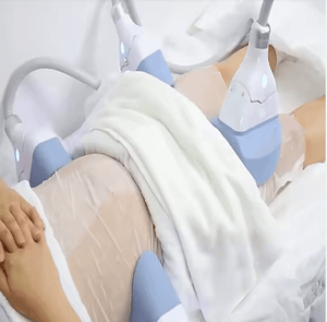 Body Cryotherapy Slimming