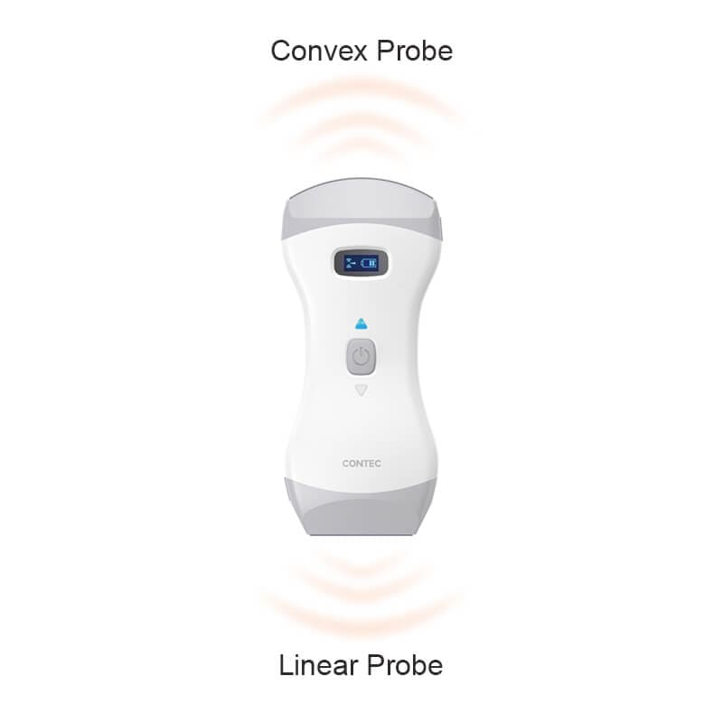 Portable Ultrasound Probe for Iphone Black Friday Deals
