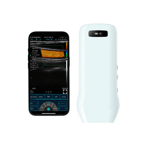 3-in-1 Wireless Ultrasound Scanner