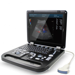Portable Ultrasound Scanner Color Doppler Machine Convex Probe