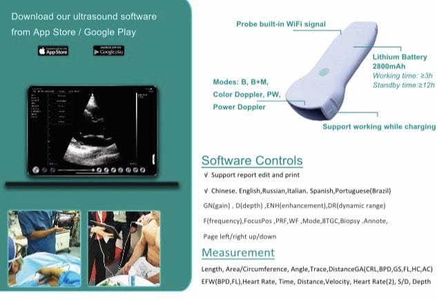 Wireless 3-in-1 Portable Pocket Handheld Ultrasound Scanner
