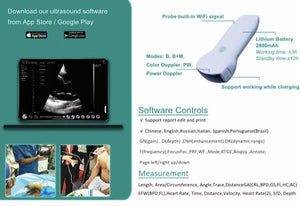 purchase ultrasound machine