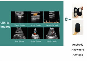 best portable ultrasound machine