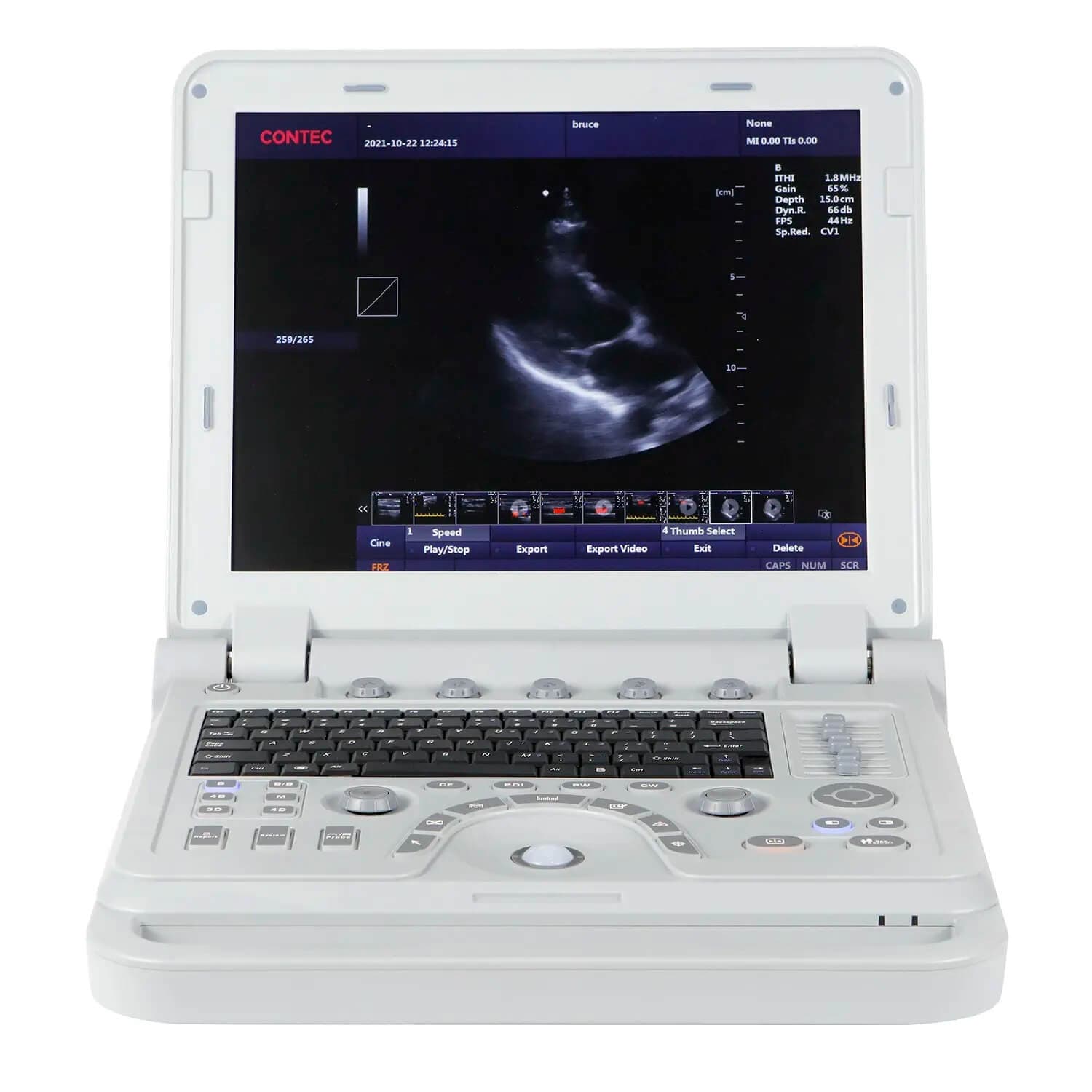 best price color doppler machine