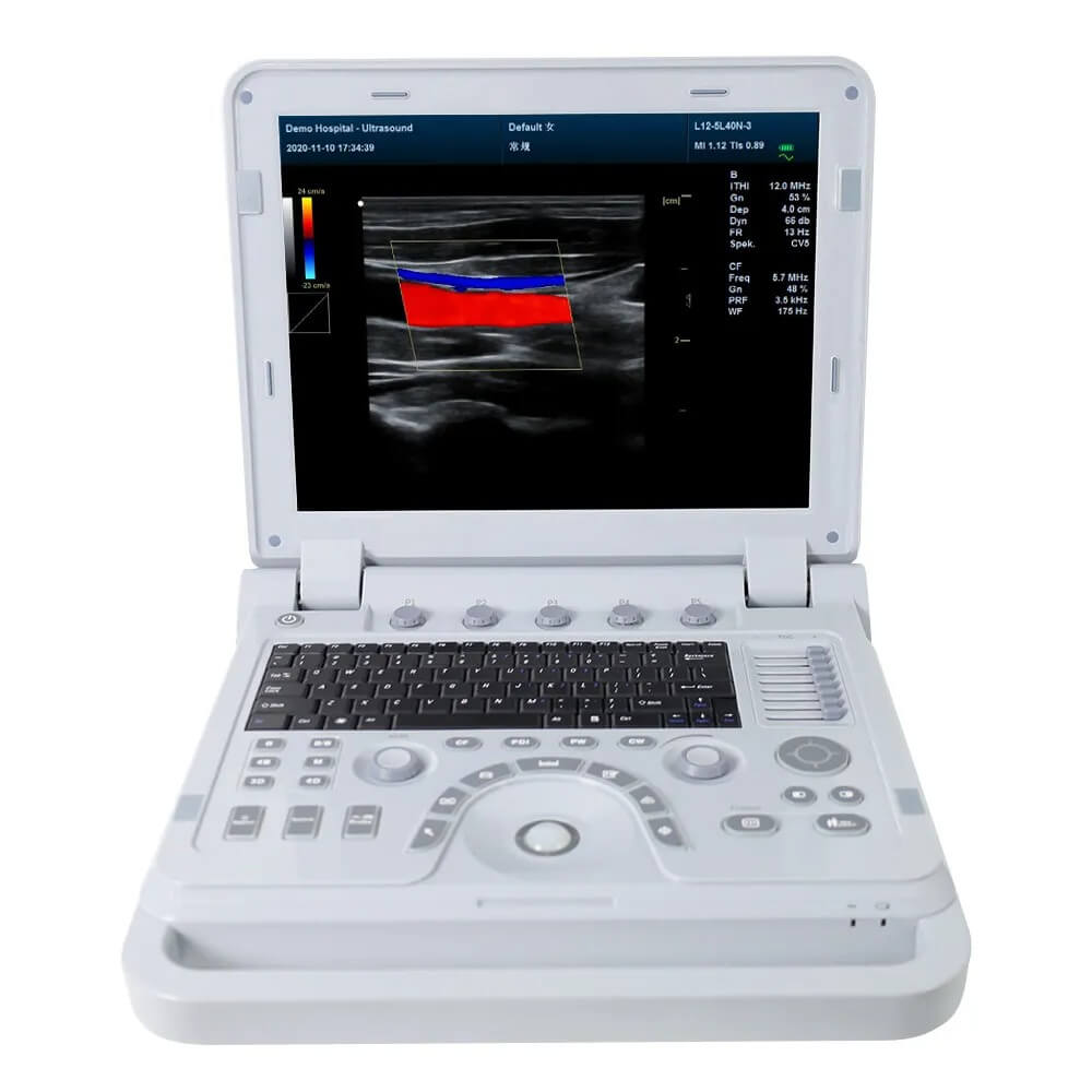 color doppler machine for sale 