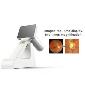 Digital Portable Hand-Held Eye Fundus Camera High Definition Imaging