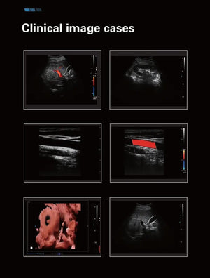 digital ultrasound scanner