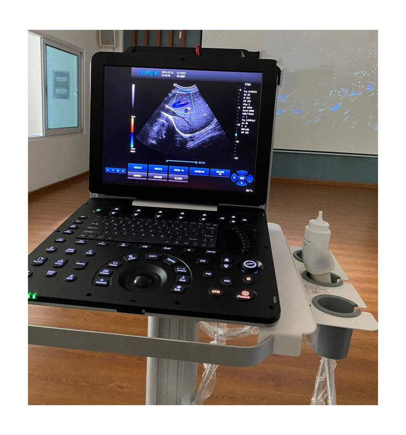 Hospital Medical 3D 4D 5D Portable Color Doppler Ultrasound Machine