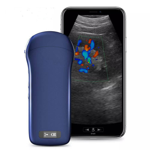3 In 1 Portable Handheld Wireless Ultrasound Scanner