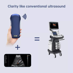 hand held ultrasound machine